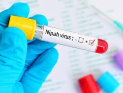 Temuan Baru Ilmuwan China: Obat COVID-19 VV116 Berpotensi Jadi Obat Virus Nipah