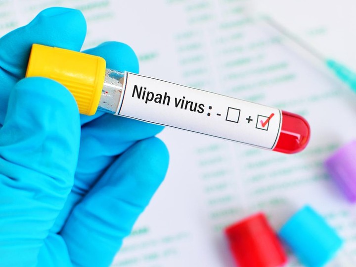 Obat Virus Nipah