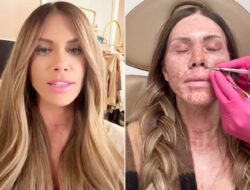 Jessi Ngatikaura Mengungkap Kekecewaan Oplas Mahal yang Mengubah Hidupnya