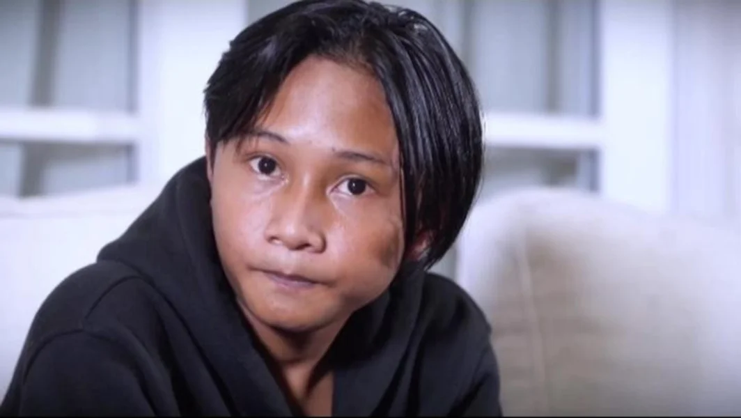 Fajar Sadboy Kecelakaan Motor