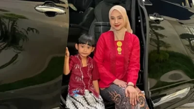 Perubahan Wajah Ria Ricis