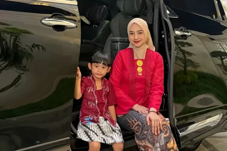 Perubahan Wajah Ria Ricis