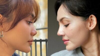 Rina Nose Usai Rhinoplasty